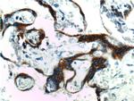 hCG beta Antibody in Immunohistochemistry (Paraffin) (IHC (P))