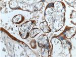 hCG beta Antibody in Immunohistochemistry (Paraffin) (IHC (P))