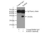 RAB20 Antibody in Immunoprecipitation (IP)