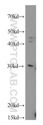 RAB20 Antibody in Western Blot (WB)