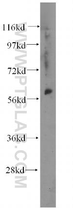 DDX28 Antibody in Western Blot (WB)