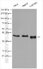 FTSJ1 Antibody in Western Blot (WB)