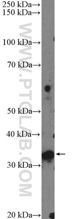 FTSJ1 Antibody in Western Blot (WB)
