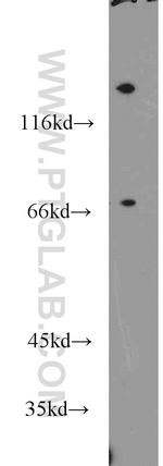 NEIL3 Antibody in Western Blot (WB)