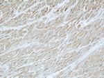 DOCK8 Antibody in Immunohistochemistry (Paraffin) (IHC (P))