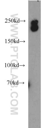 DOCK8 Antibody in Western Blot (WB)