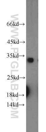CDCA4 Antibody in Western Blot (WB)