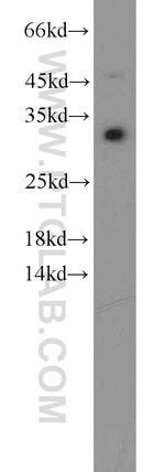 CDCA4 Antibody in Western Blot (WB)