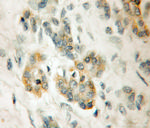 LRR 1 Antibody in Immunohistochemistry (Paraffin) (IHC (P))