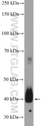Podoplanin Antibody in Western Blot (WB)