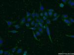 MIG6/ERRFI1 Antibody in Immunocytochemistry (ICC/IF)