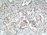 ZMYND8 Antibody in Immunohistochemistry (Paraffin) (IHC (P))