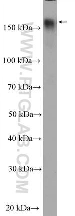 ZMYND8 Antibody in Western Blot (WB)