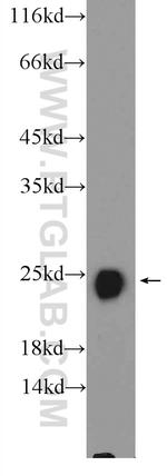TNNI2 Antibody in Western Blot (WB)