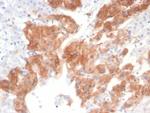 IL22RA2 Monoclonal Antibody (IL22RA2/7291)