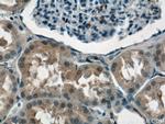 NPLOC4 Antibody in Immunohistochemistry (Paraffin) (IHC (P))