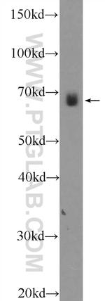 NPLOC4 Antibody in Western Blot (WB)