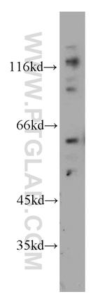 CDC6 Antibody in Western Blot (WB)
