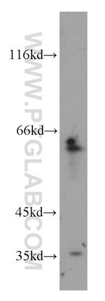 CDC6 Antibody in Western Blot (WB)