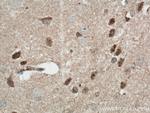CDC6 Antibody in Immunohistochemistry (Paraffin) (IHC (P))