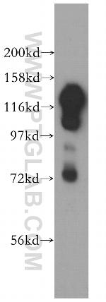SAFB2 Antibody in Western Blot (WB)