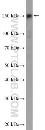 SAFB2 Antibody in Western Blot (WB)