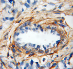 Gelsolin Antibody in Immunohistochemistry (Paraffin) (IHC (P))