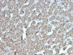 Topoisomerase I Mitochondrial (TOP1MT) Recombinant Mouse Monoclonal Antibody (rTOP1MT/488)