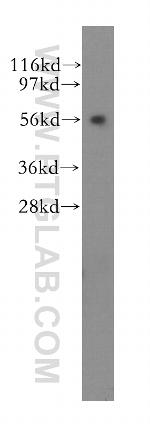 KLC3 Antibody in Western Blot (WB)