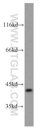 SLC22A18 Antibody in Western Blot (WB)