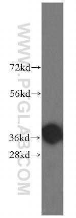 SLC22A18 Antibody in Western Blot (WB)