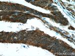 PPIH Antibody in Immunohistochemistry (Paraffin) (IHC (P))