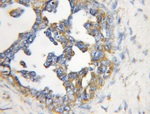 EPHA2 Antibody in Immunohistochemistry (Paraffin) (IHC (P))