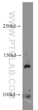 EPHA2 Antibody in Western Blot (WB)