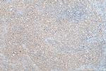 AP4M1 Antibody in Immunohistochemistry (Paraffin) (IHC (P))
