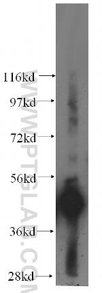AP4M1 Antibody in Western Blot (WB)