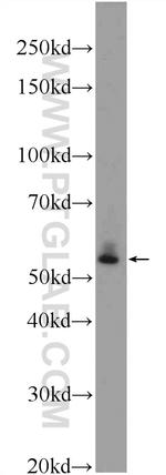 AP4M1 Antibody in Western Blot (WB)