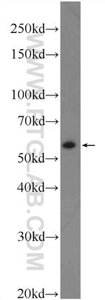 AP4M1 Antibody in Western Blot (WB)