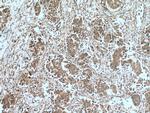 HHIP Antibody in Immunohistochemistry (Paraffin) (IHC (P))