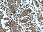 HHIP Antibody in Immunohistochemistry (Paraffin) (IHC (P))