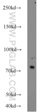 HHIP Antibody in Western Blot (WB)