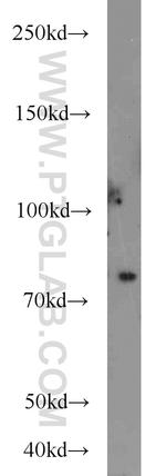 HHIP Antibody in Western Blot (WB)