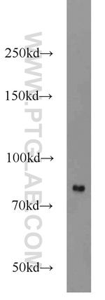 HHIP Antibody in Western Blot (WB)