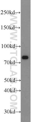 HHIP Antibody in Western Blot (WB)