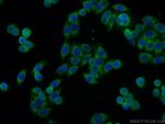 SSR4 Antibody in Immunocytochemistry (ICC/IF)