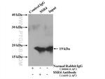 SSR4 Antibody in Immunoprecipitation (IP)