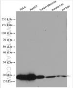 SSR4 Antibody in Western Blot (WB)