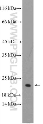 SSR4 Antibody in Western Blot (WB)