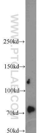 INTS9 Antibody in Western Blot (WB)