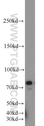 INTS9 Antibody in Western Blot (WB)